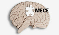 運用型広告コンサルタントのMECE思考